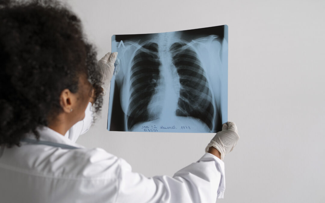 COPD (Chronic Obstructive Pulmonary Disease)